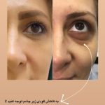 کلینیک درمان بیماری ناخن پادینا در قزوین