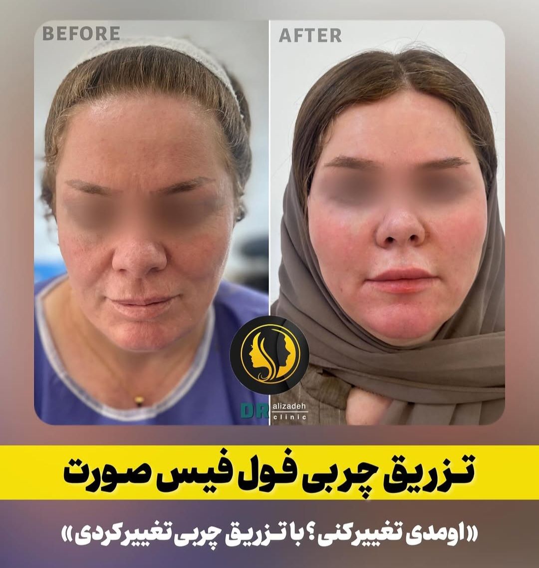فرم دهی صورت و جوانسازی پوست در کلینیک دکتر علیزاده-مشاغل ممتاز