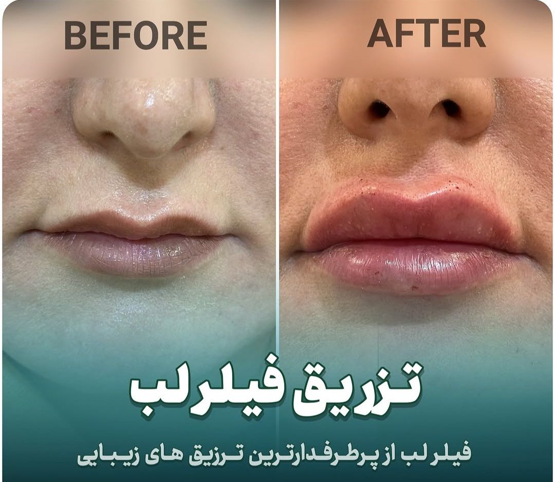 مشاوره و انجام خدمات زیبایی در کلینیک دکتر علیزاده پیرانشهر-مشاغل ممتاز
