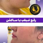 کلینیک زیبایی دکتر علیزاده در پیرانشهر