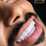 خدمات دندانپزشکی رویا دنتال در رشت