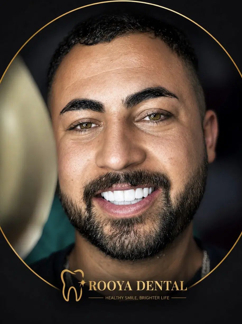 کامپوزیت دندان در دندانپزشکی رویا دنتال رشت با متریال درجه یک و طراحی لبخند طبیعی_مشاغل ممتاز