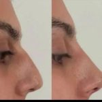 کلینیک زیبایی آیلین در تهران