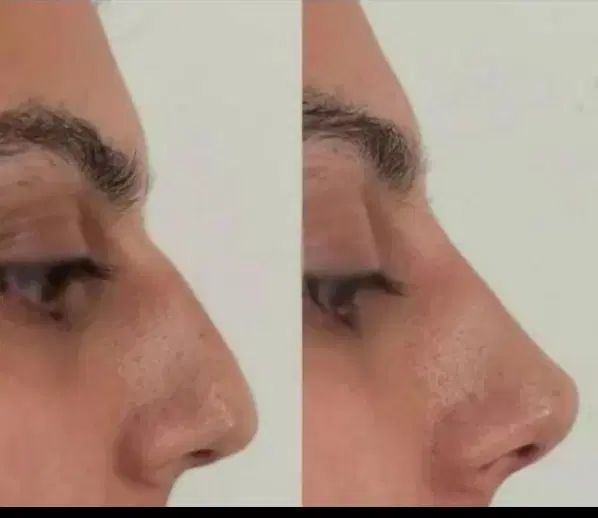 کلینیک زیبایی آیلین در تهران