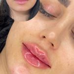 مرکز زیبایی دکتر مهتا غیرتی بجنورد