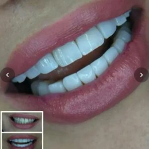 دندانپزشکی دکتر فرشاد عبدی خرم‌آباد ارائه خدمات تخصصی دندانپزشکی در خرم‌آباد -مشاغل ممتاز