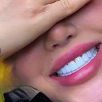دندانپزشکی دکتر فرشاد عبدی خرم‌آباد