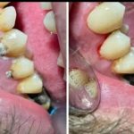 مطب دندانپزشکی دکتر دیار مینایی ارومیه