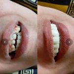 مطب دندانپزشکی دکتر دیار مینایی ارومیه