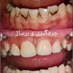 مطب دندانپزشکی دکتر دیار مینایی ارومیه