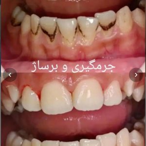 مطب دندانپزشکی دکتر دیار مینایی ارومیه-مشاغل ممتاز