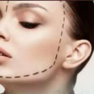 کلینیک زیبایی لیلا سلیمانی تبریز-مشاغل ممتاز