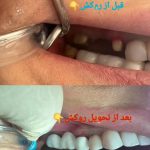 دندانپزشکی آوا شهرقدس