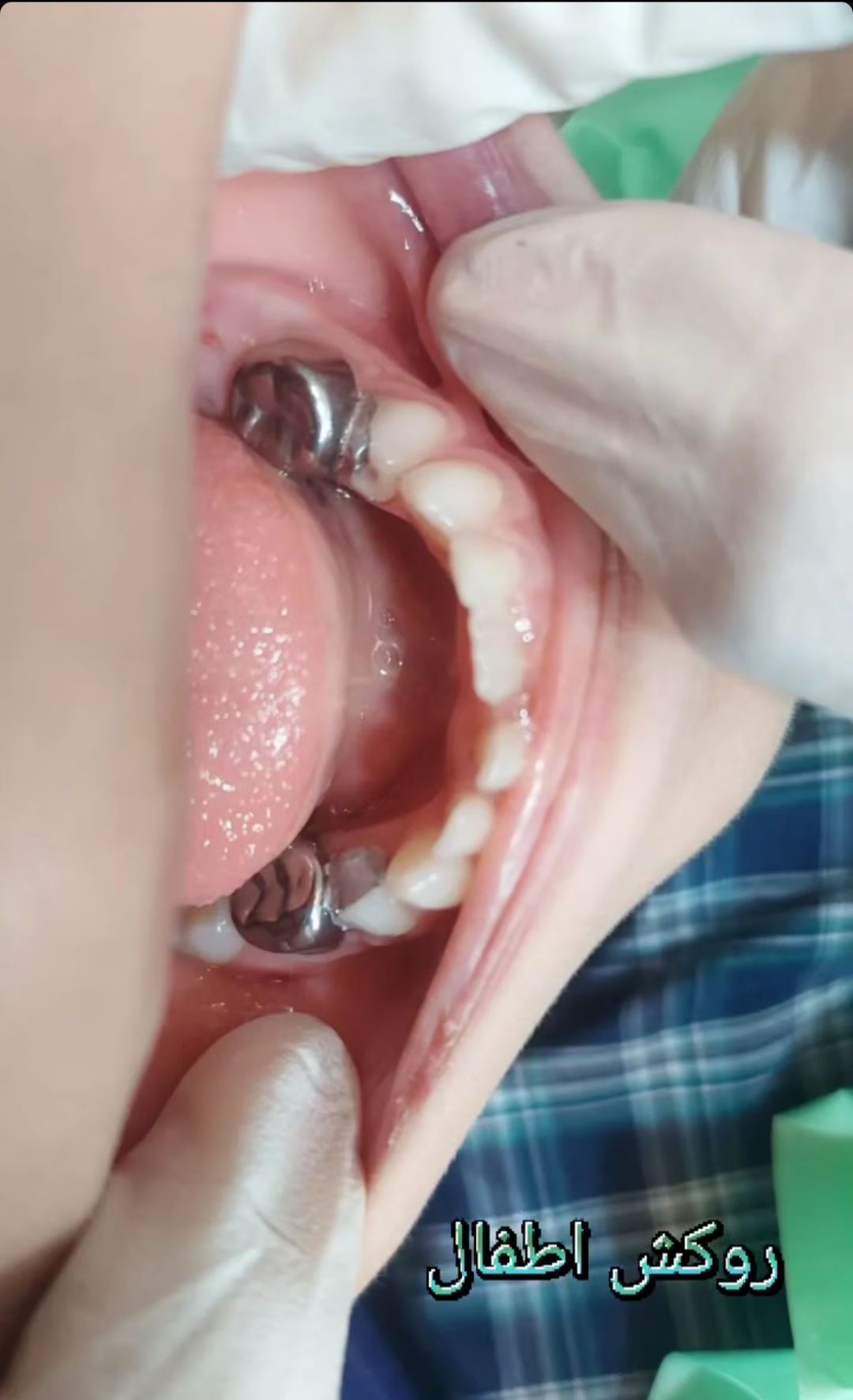دکتر دندانپزشک در حال معاینه بیمار در کلینیک آوا شهرقدس-مشاغل ممتاز