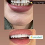 دندانپزشکی آوا شهرقدس