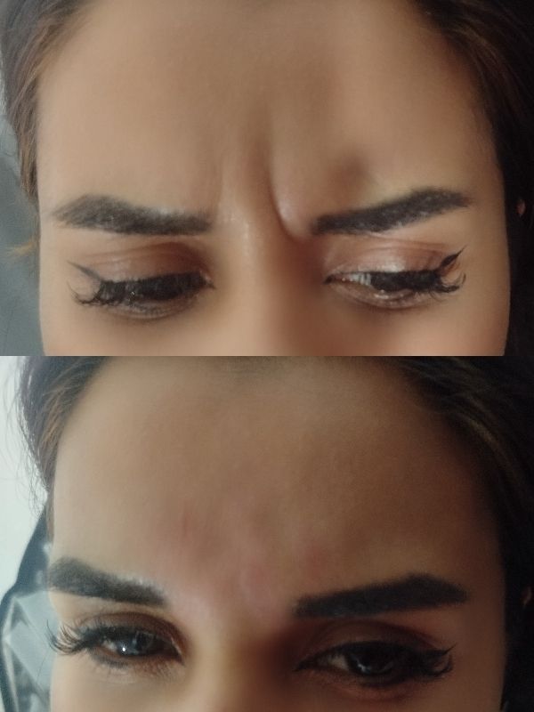 بوتاکس بهار چراغی ساوه- مشاغل ممتاز