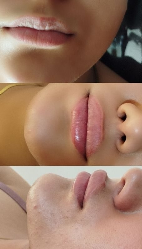 فیلر لب بهار چراغی ساوه- مشاغل ممتاز