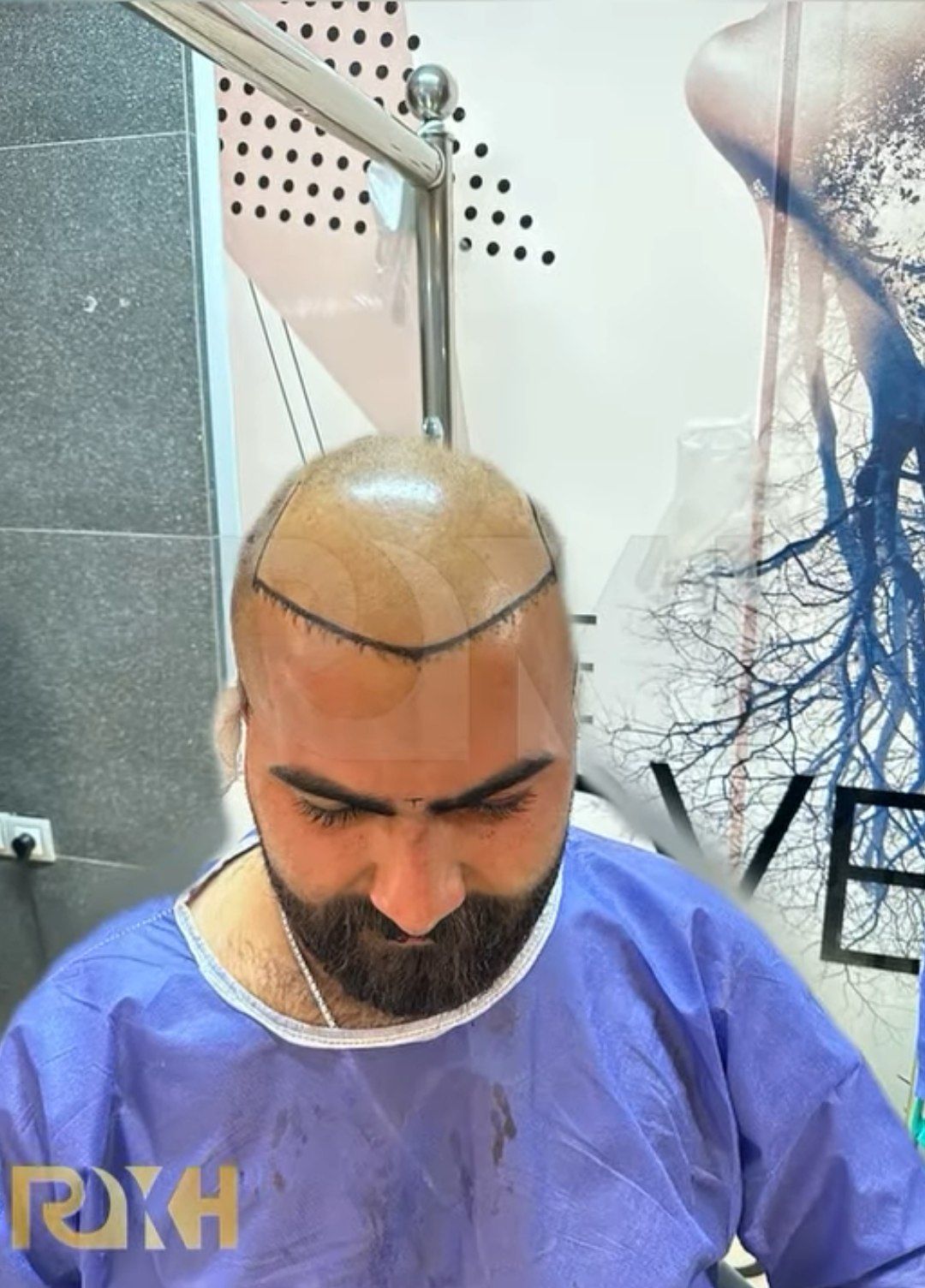 کلینیک کاشت مو در شیراز-مشاغل ممتاز