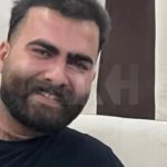 کلینیک کاشت مو رخ در شیراز