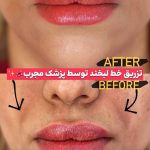 کلینیک پوست و مو لیلی در گوهردشت کرج