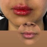 کلینیک زیبایی الیزه در سناباد مشهد