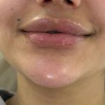 کلینیک زیبایی الیزه در سناباد مشهد