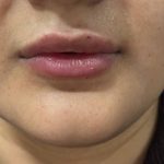کلینیک زیبایی الیزه در سناباد مشهد