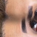 کلینیک زیبایی ابرا در پرند