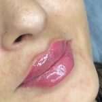 کلینیک زیبایی ابرا در پرند