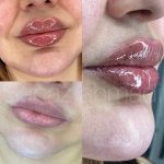 کلینیک زیبایی ابرا در پرند