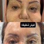 مطب زیبایی آتی بیوتی در کرج