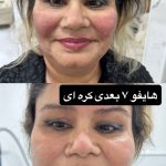 مطب زیبایی آتی بیوتی در کرج
