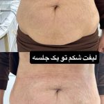 مطب زیبایی آتی بیوتی در کرج