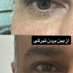مطب زیبایی آتی بیوتی در کرج