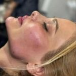 کلینیک زیبایی برزگر تبریز