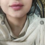 کلینیک زیبایی برزگر تبریز