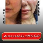 کلینیک زیبایی و لاغری حمیدی رشت