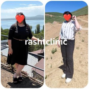 کلینیک زیبایی و لاغری حمیدی رشت-مشاغل ممتاز