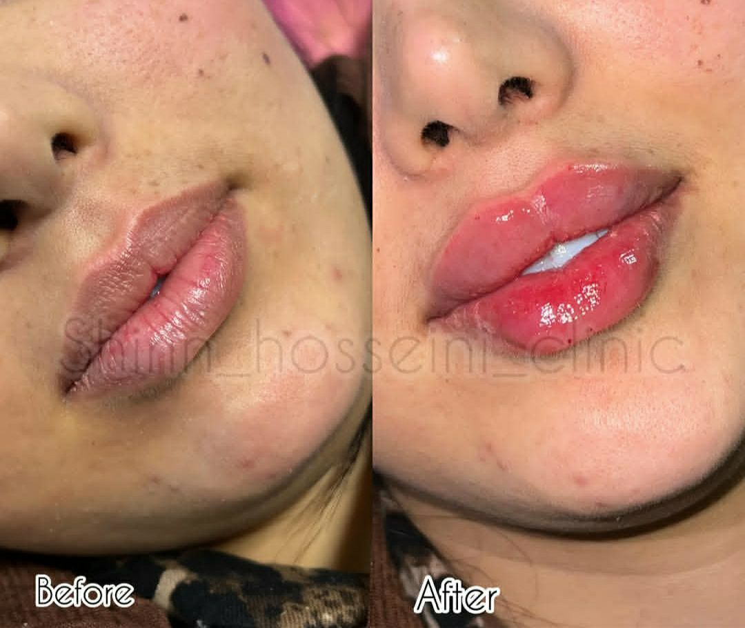 مشاوره تخصصی زیبایی و جوانسازی در کلینیک زیبایی شیرین حسینی اهواز - مشاغل ممتاز
