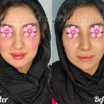 کلینیک زیبایی شیرین حسینی اهواز