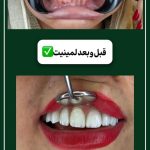 کلینیک دندانپزشکی دیجیتال اُپال کرمان