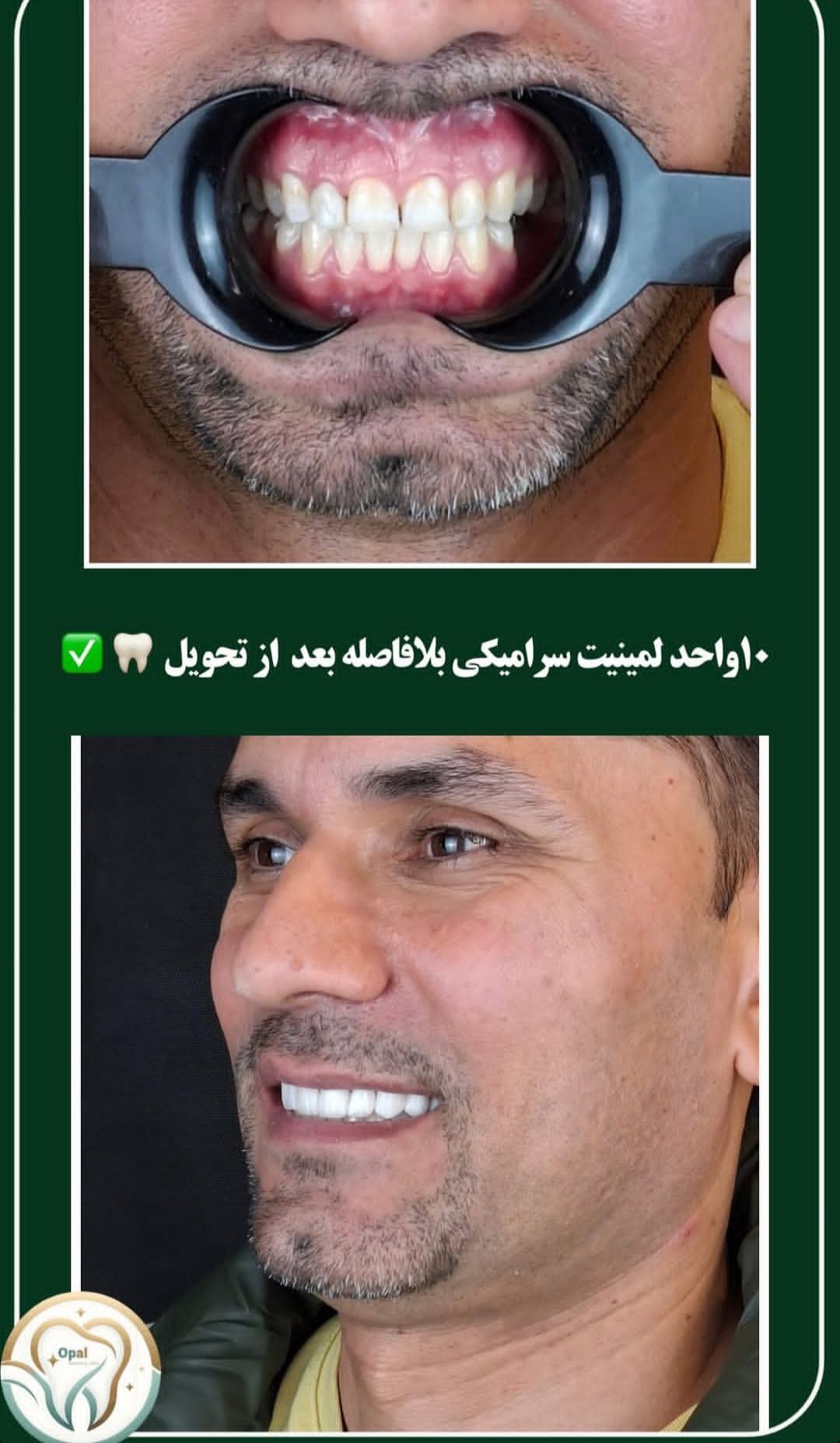 تصویربرداری سه بعدی فک و دندان در کلینیک دندانپزشکی دیجیتال اپال کرمان