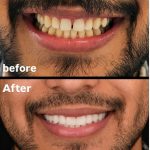 کلینیک دندانپزشکی دیجیتال اُپال کرمان