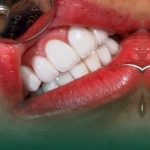 کلینیک دندانپزشکی دیجیتال اُپال کرمان