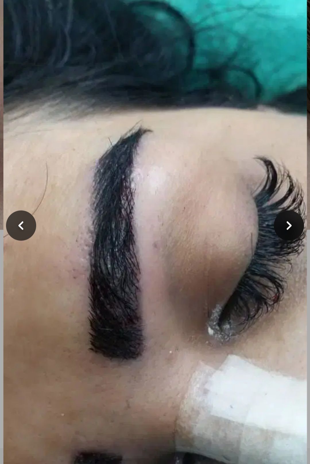 کاشت ابرو با خواب طبیعی مو در مرکز کاشت شریف زاده اصفهان -مشاغل ممتاز