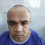 مرکز کاشت مو و ابرو شریف زاده در اصفهان
