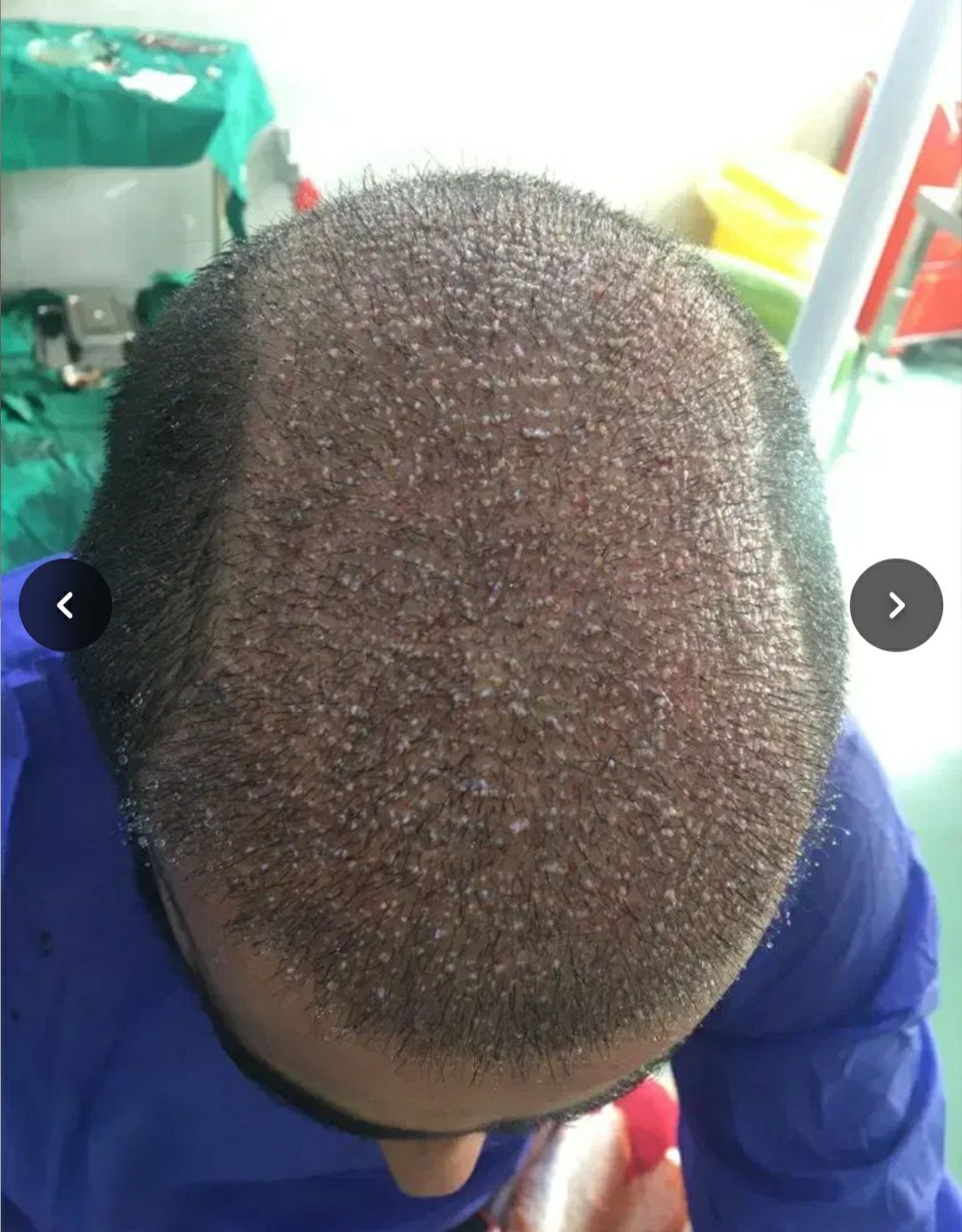  کلینیک کاشت مو و ابرو شریف زاده در اصفهان با طراحی طبیعی چهره -مشاغل ممتاز