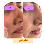 مرکز تخصصی الکترولیز رویا رضایی در ارومیه