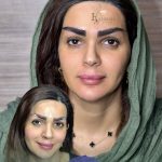 مرکز کاشت مو و ابرو بهاره حسینی در اهواز