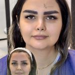 مرکز کاشت مو و ابرو بهاره حسینی در اهواز